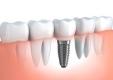 Advanced Dentistry of Coral Springs