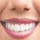 Elite Smiles Dental Center